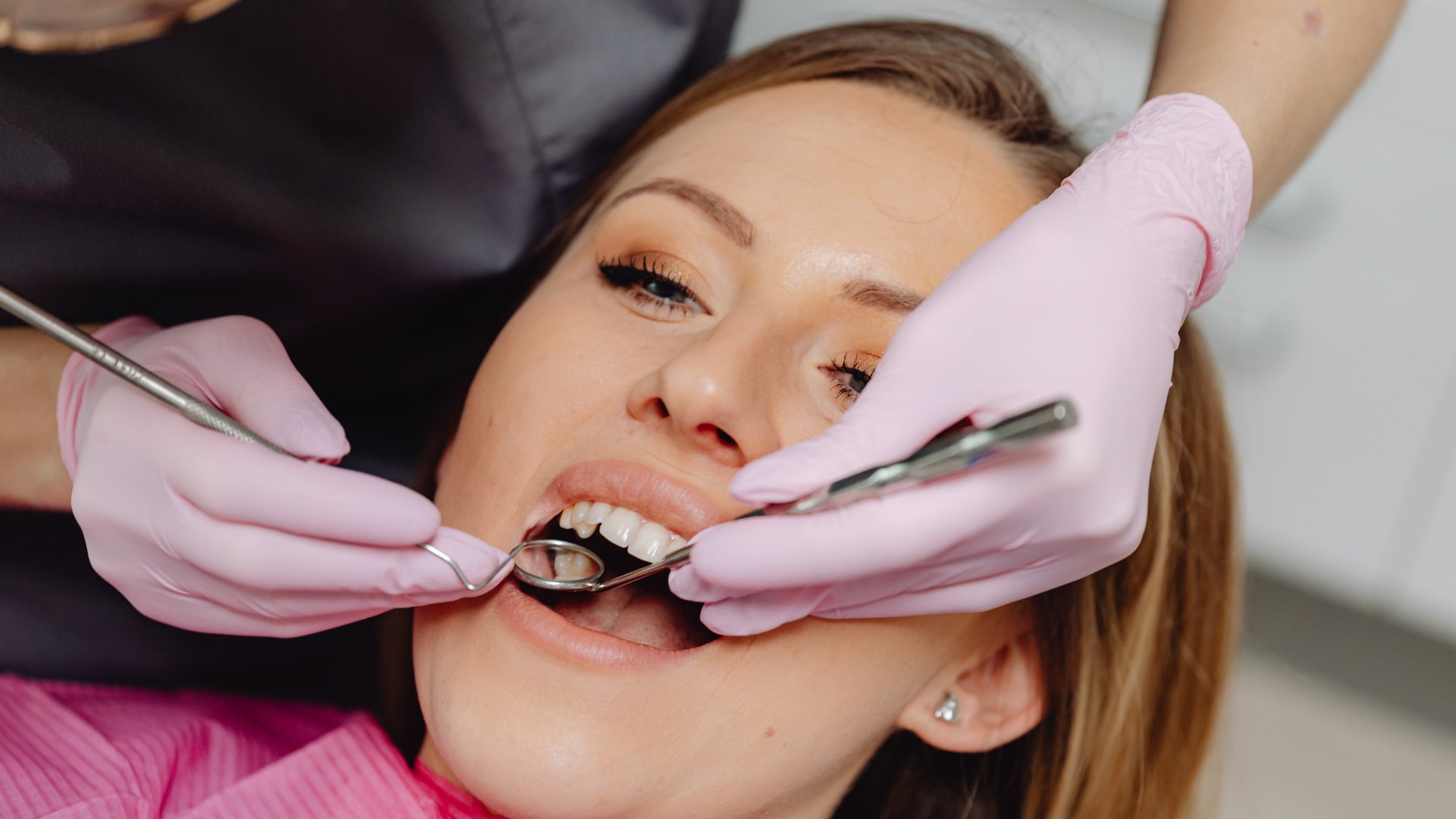 Close-up of dental crown placement procedure